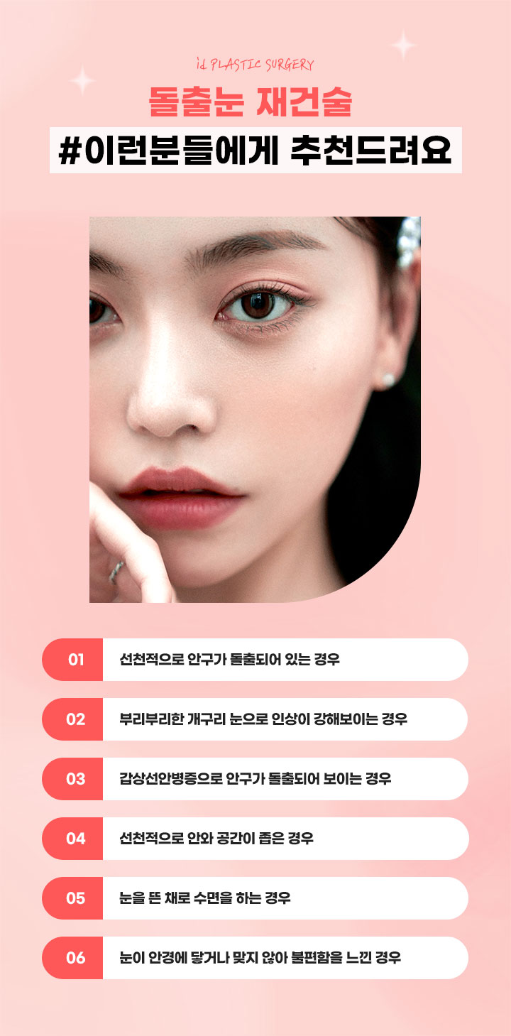 돌출눈 재건술 추천