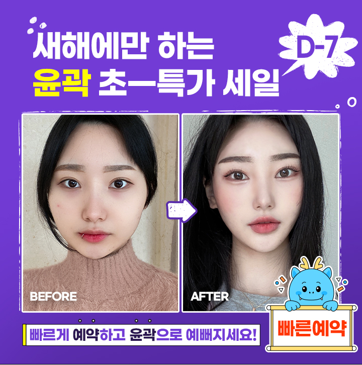 새해에만 하는 윤곽 초-특가 세일 D-7 빠르게 예약하고 윤곽으로 예뻐지세요! 빠른예약