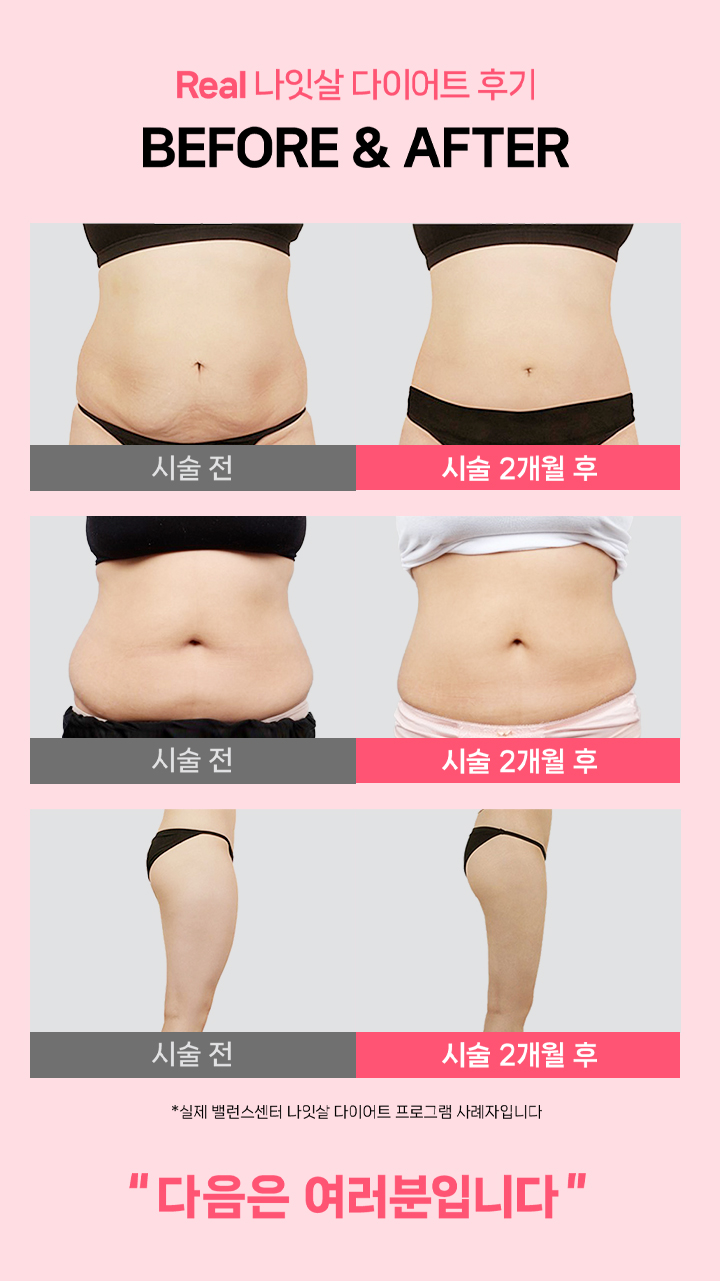 Real 나잇살 다이어트 후기 BEFORE ＆ AFTER