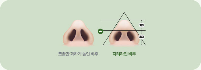 자려라인 비주