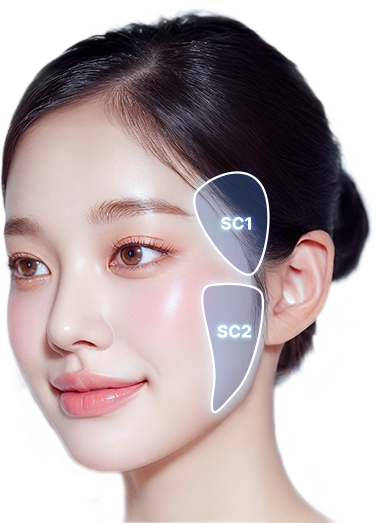 벡터 리프팅 시술 부위. SC1, SC2 구간을 표시한 얼굴 이미지