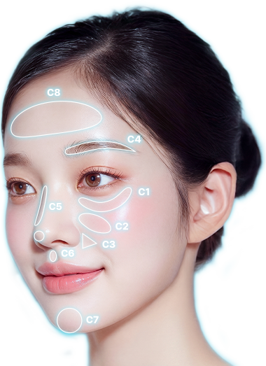 표면 리프팅 시술 부위를 표시한 얼굴 이미지