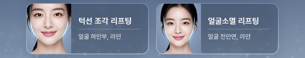 턱선 조각 리프팅. 얼굴 하안부, 라인. 얼굴소멸 리프팅. 얼굴 전안면, 라인