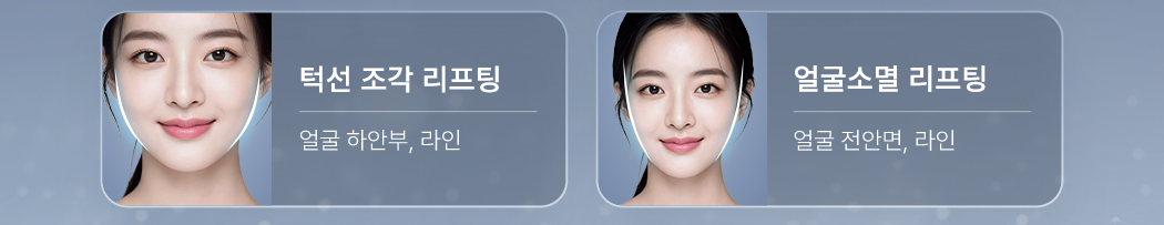 턱선 조각 리프팅. 얼굴 하안부, 라인. 얼굴소멸 리프팅. 얼굴 전안면, 라인
