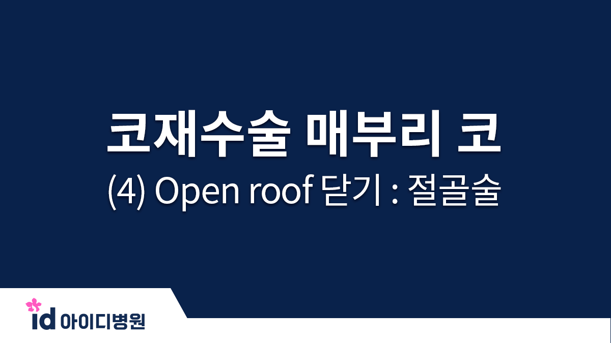 코재수술 매부리 코 (4) Open roof 닫기 : 절골술