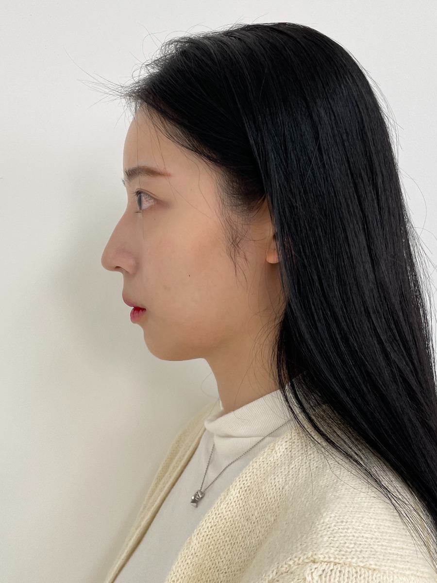 이미지 4