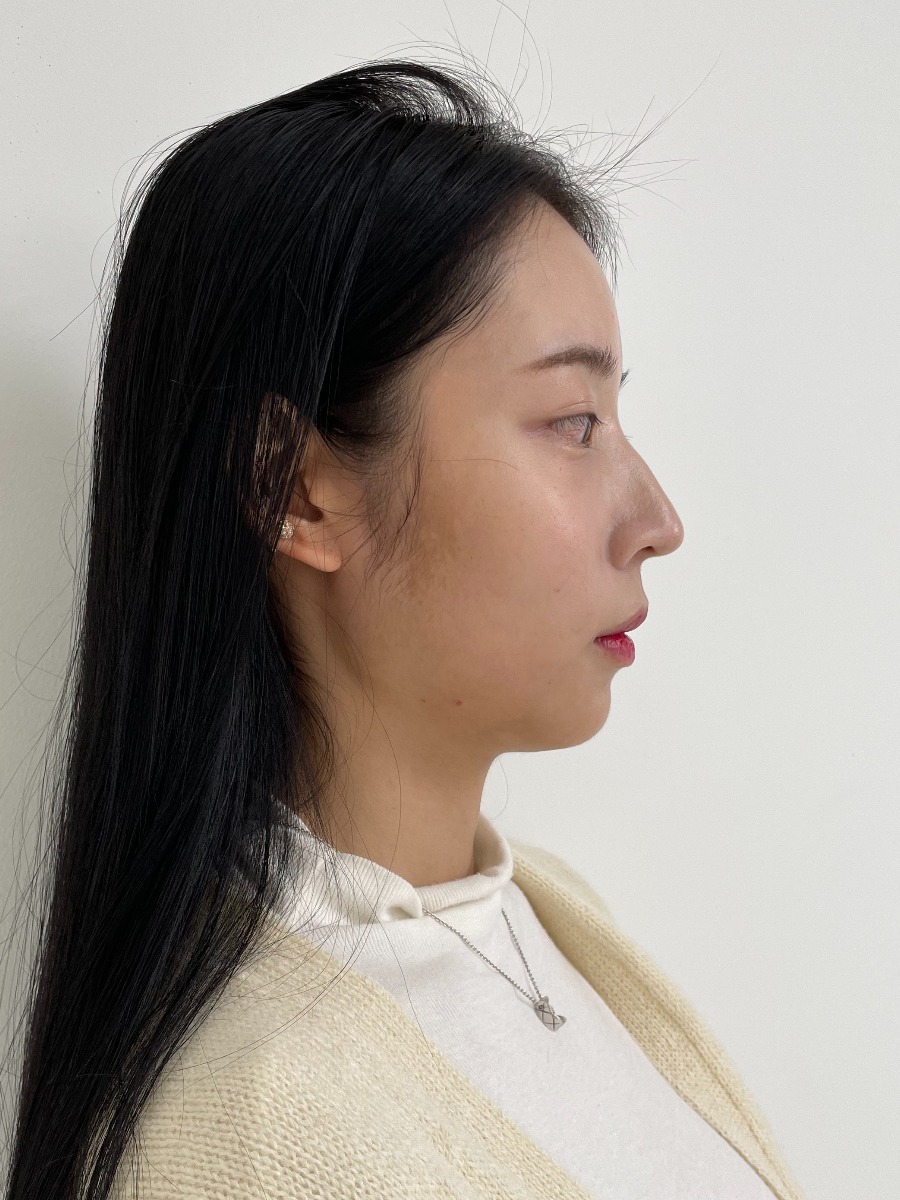 이미지 5