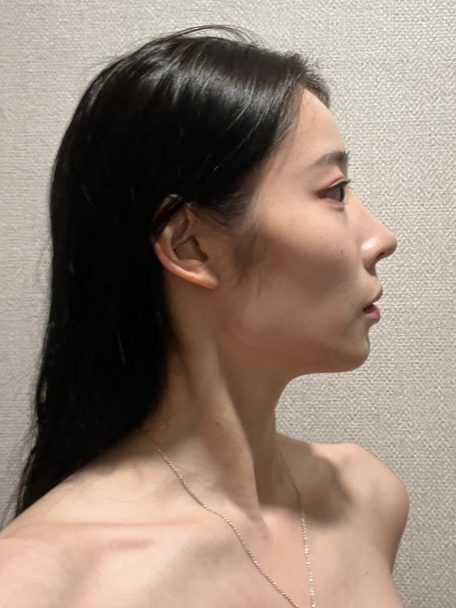 이미지 5