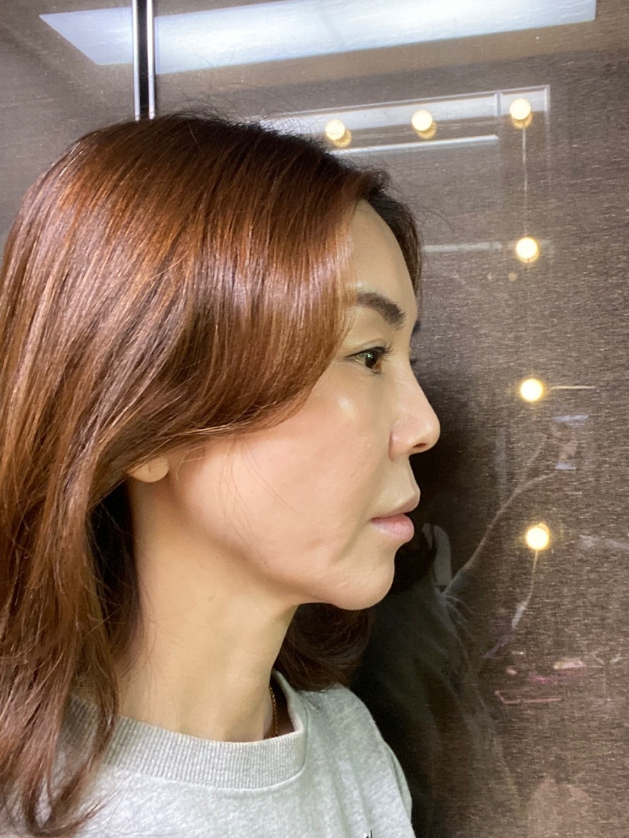 이미지 5