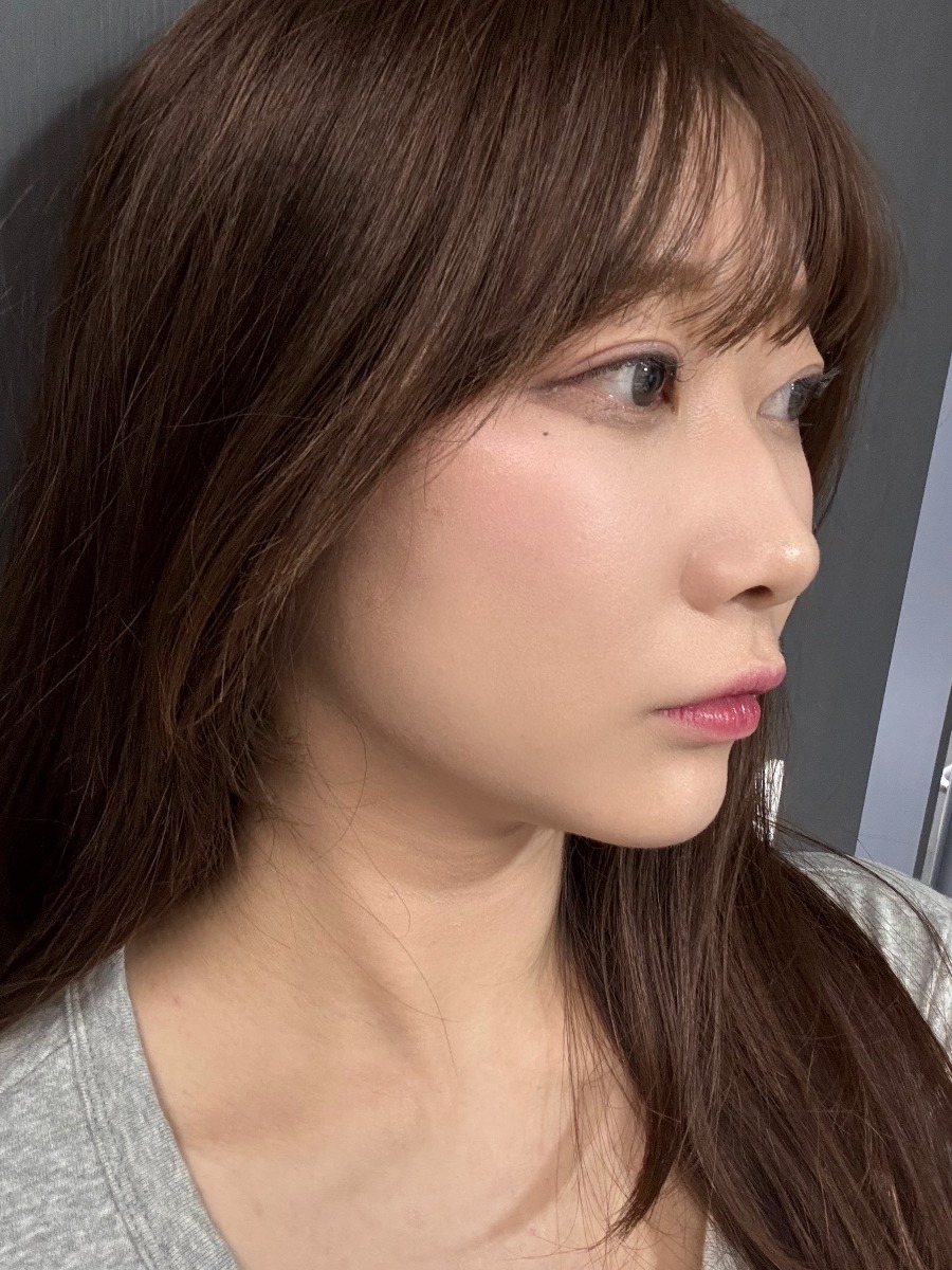 이미지 5