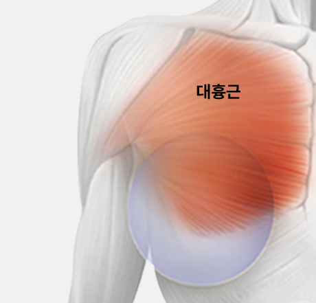 이중평면법