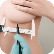 아이디병원 - 가슴 바운스 보형물 - 내 체형에 맞는 설계 - 좌우 비대칭