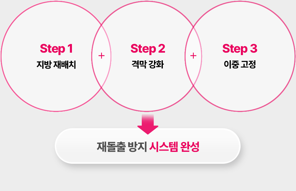 아이디병원 - 눈밑지방재배치 - 재돌출 방지 시스템 완성