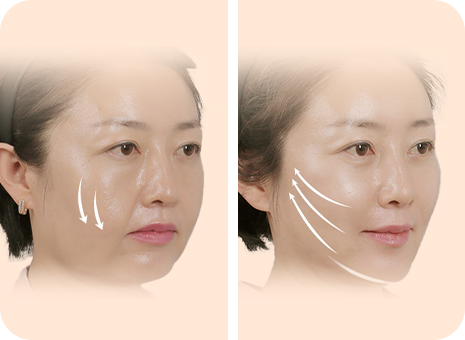 탄탄한 V라인