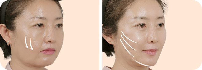 탄탄한 V라인