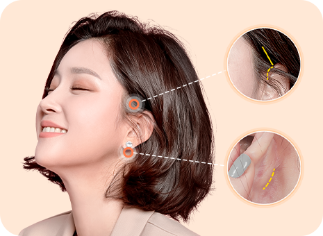리프팅 효과는 보여도 흉터는 숨겨야지!