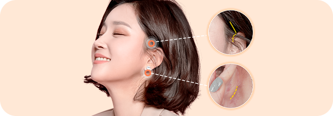 리프팅 효과는 보여도 흉터는 숨겨야지!