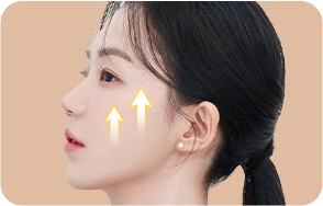 아이디병원 - 미니심부거상술 - 미니 심부거상술 수술 방법 - 피부의 처진 조직을 수직방향으로 리프팅