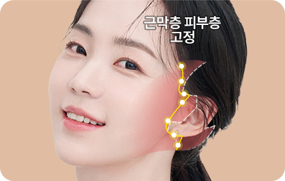 표피~근막층(SMAS)까지 4중 구조를 단단하게 고정