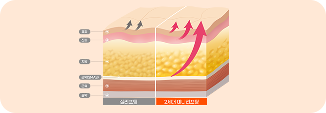 처진 피부탄력까지 UP