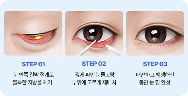 남자 하안검