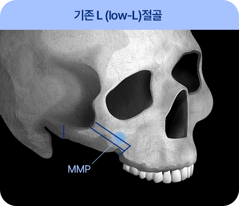 처진 피부탄력까지 UP