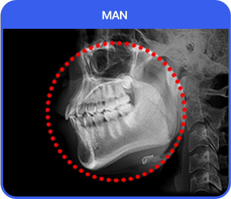 처진 피부탄력까지 UP