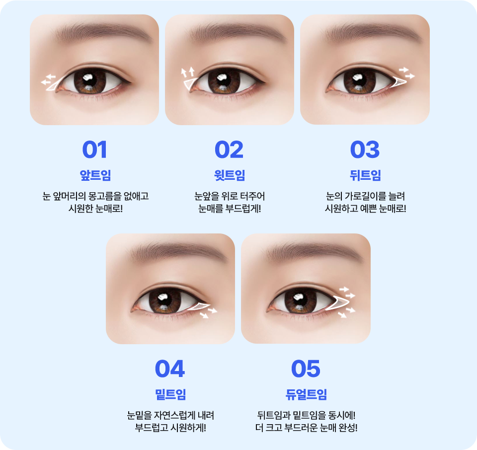 남자 앞트임