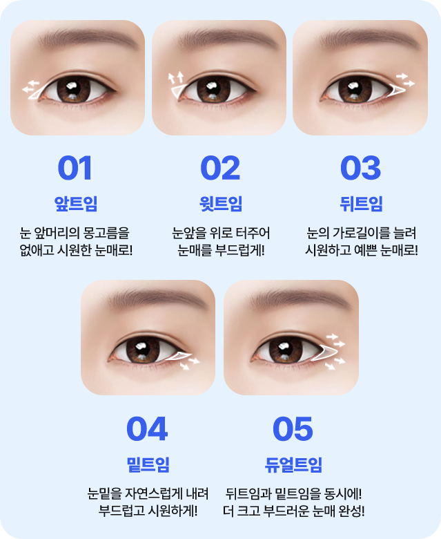 남자 앞트임