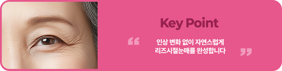 인상 변화 없이 자연스럽게리즈시절 눈매를 완성합니다