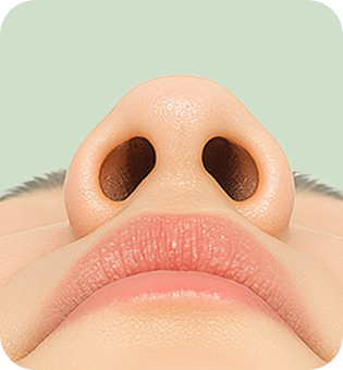 퍼진 코끝