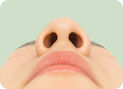 퍼진 코끝