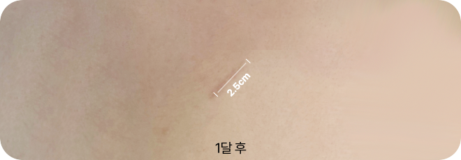 2.5cm