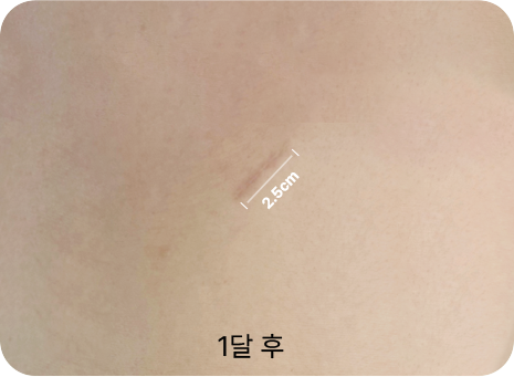 2.5cm
