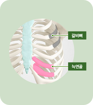 늑연골 사진