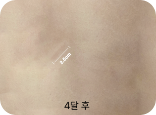 2.5cm