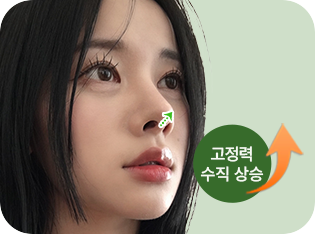 고정력 수직 상승