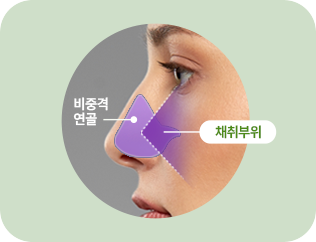 비중격 연골. 채취부위