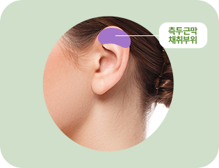 측두근막 채취부위