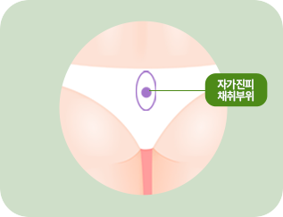 자가진피 채취부위