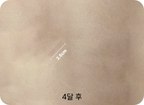 2.5cm