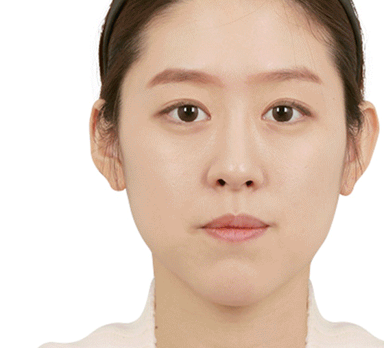정면
