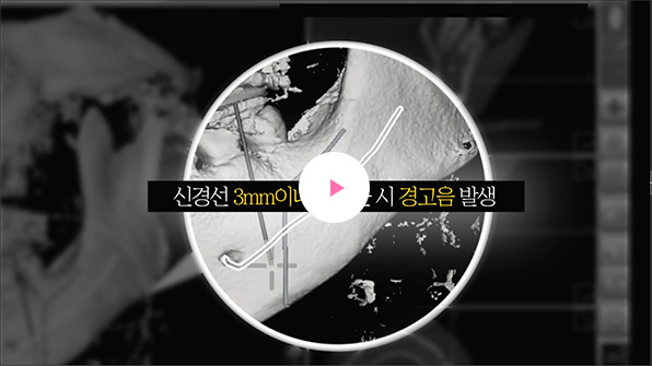 썸네일1